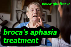 broca's aphasia treatment