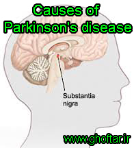Causes of Parkinson's disease